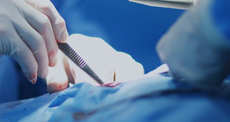 Surgical Instruments 